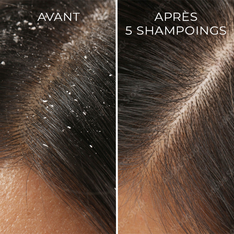 Shampoing traitant anti-pelliculaire Bio Api'Propolis